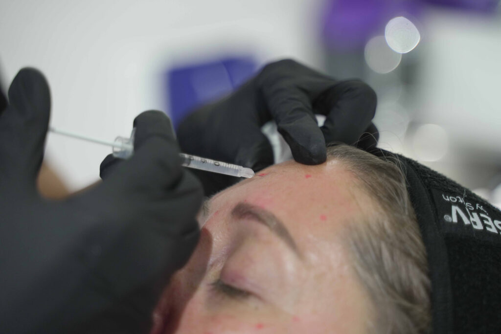 Botox Exeter - Botox anti wrinkle injections