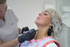 Profhilo Treatment Exeter at Exthetics