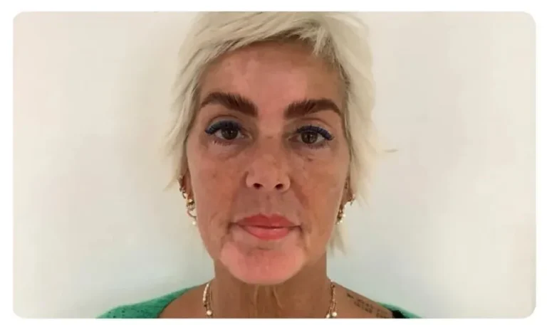 Obagi Skincare reviews Astrid Week 1