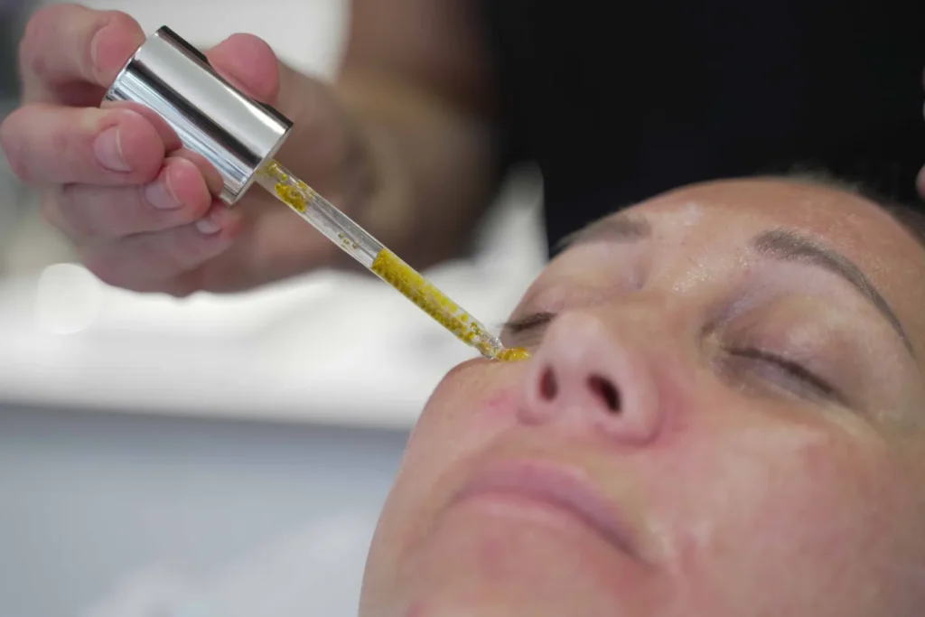 Under Eye Wrinkles treatment Exeter