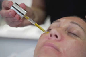 Under Eye Wrinkles treatment Exeter