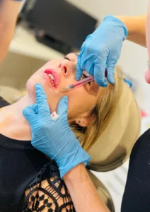 Anti-wrinkle treatemnts Exeter - dermal filler
